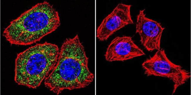 Glucocorticoid Receptor Antibody in Immunocytochemistry (ICC/IF)