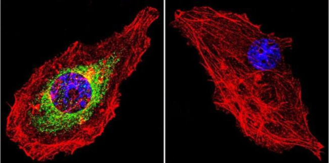 Glucocorticoid Receptor Antibody in Immunocytochemistry (ICC/IF)