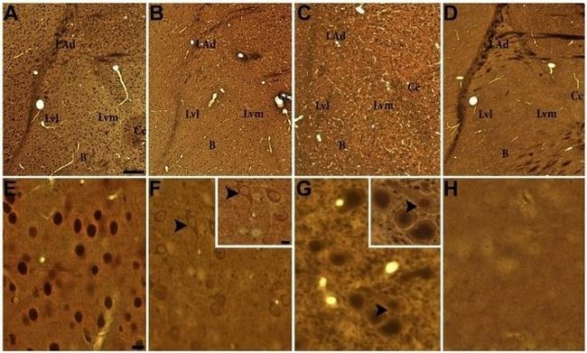 Glucocorticoid Receptor Antibody in Immunohistochemistry (IHC)