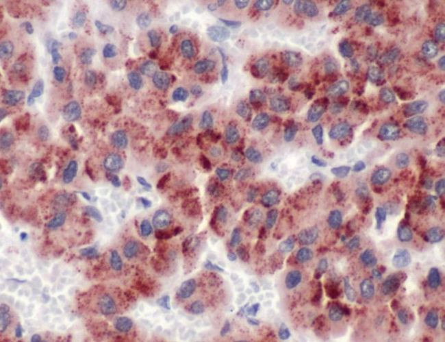 Glypican 3 Antibody in Immunohistochemistry (Paraffin) (IHC (P))