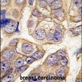 H-cadherin Antibody in Immunohistochemistry (IHC)