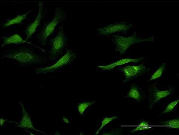 SERPINA3 Antibody in Immunocytochemistry (ICC/IF)