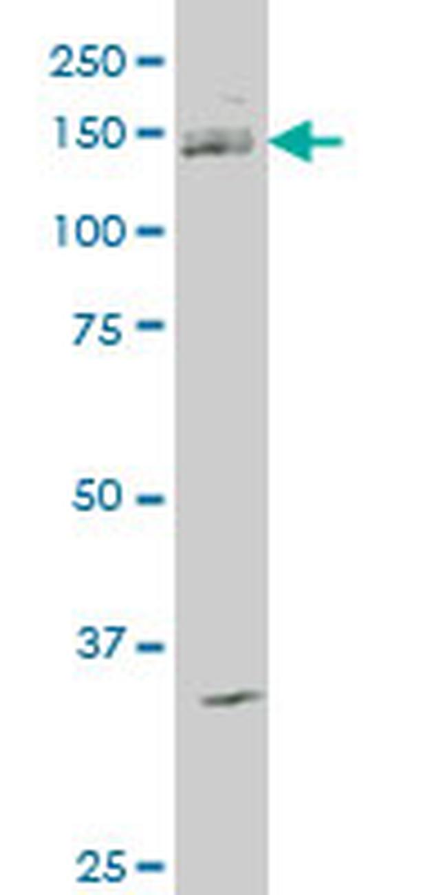 ABL2 Antibody in Western Blot (WB)