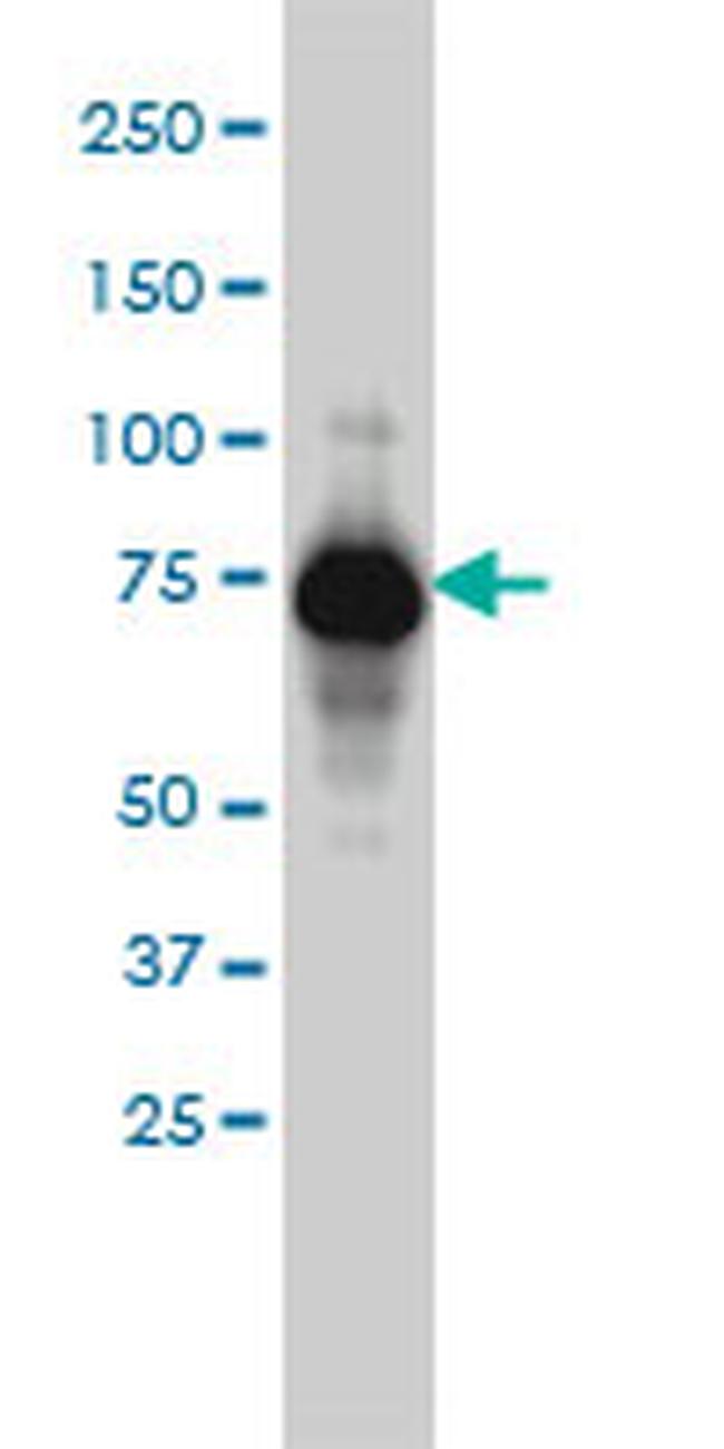 ADD1 Antibody in Western Blot (WB)