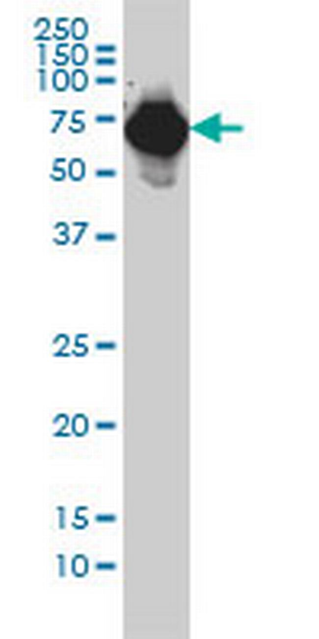 AFP Antibody in Western Blot (WB)