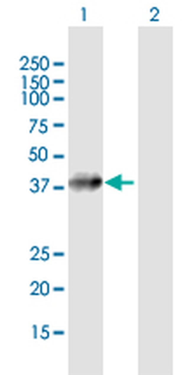 AGA Antibody in Western Blot (WB)