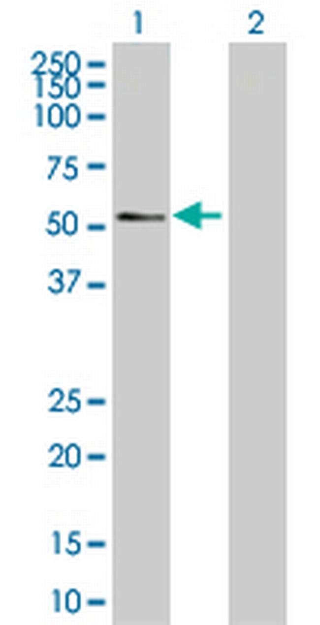 AGER Antibody in Western Blot (WB)