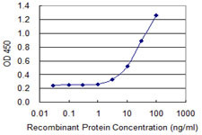 AK2 Antibody in ELISA (ELISA)