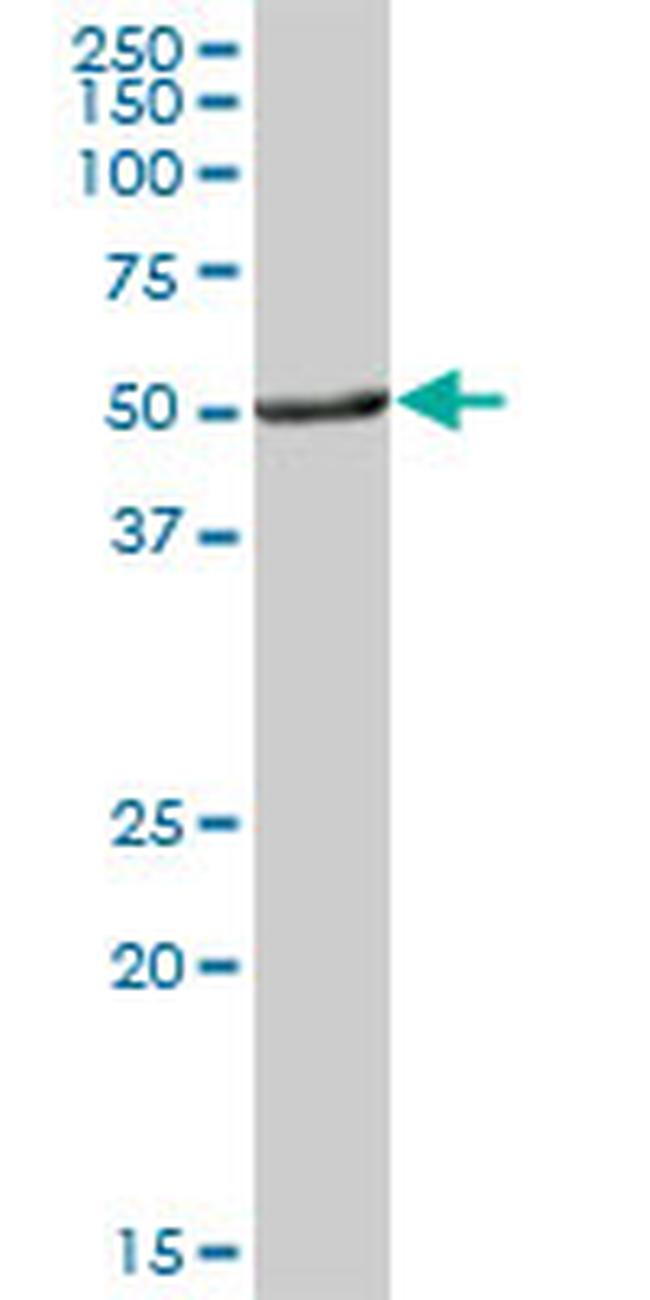 ALDH3A1 Antibody in Western Blot (WB)