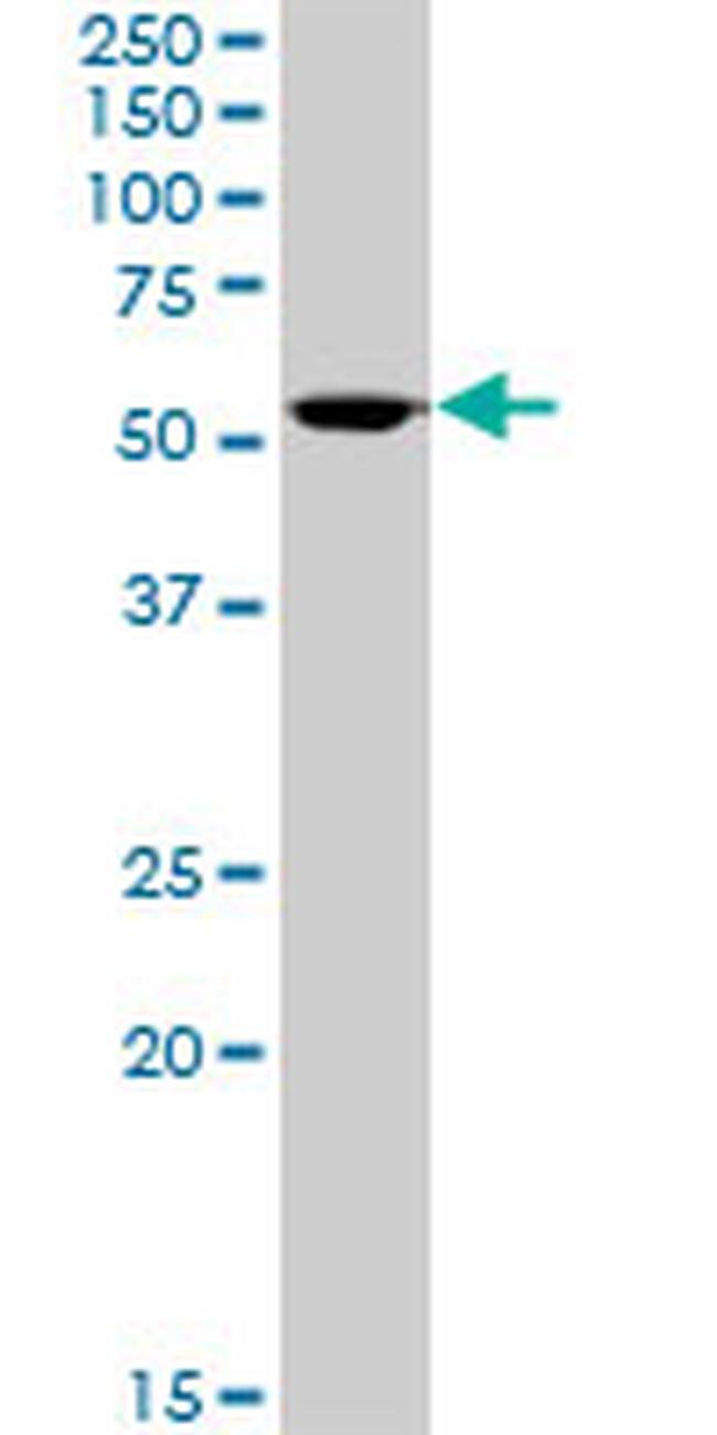 ALDH3A1 Antibody in Western Blot (WB)