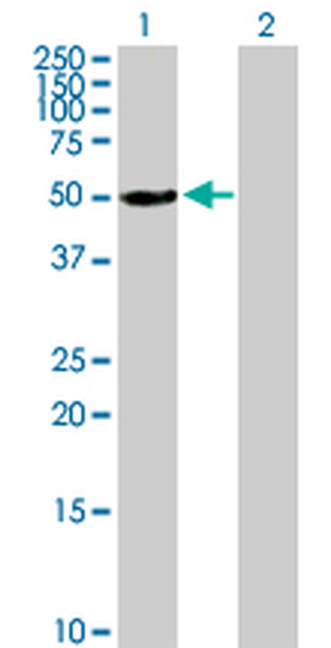 ALDH3A1 Antibody in Western Blot (WB)