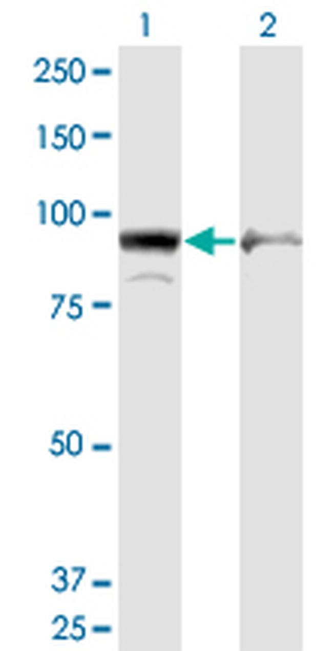 AMPD2 Antibody in Western Blot (WB)