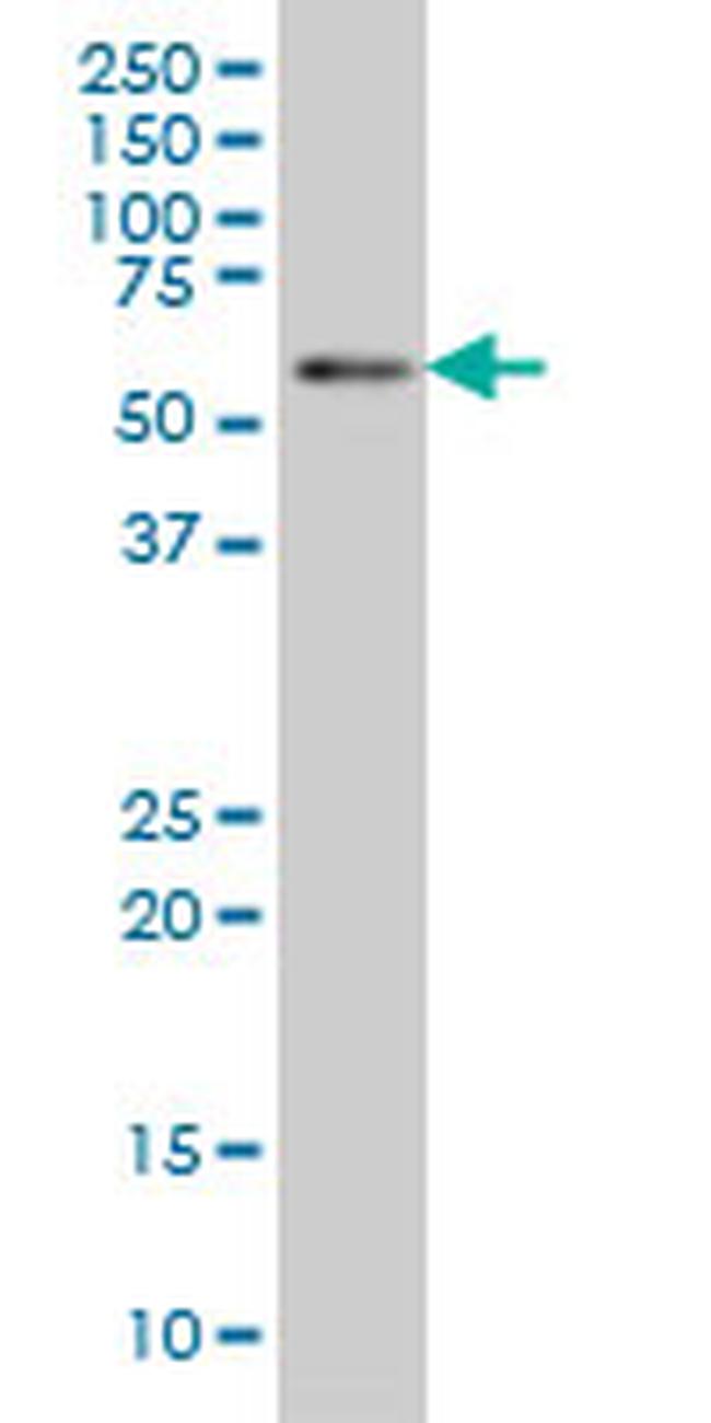 BIN1 Antibody in Western Blot (WB)