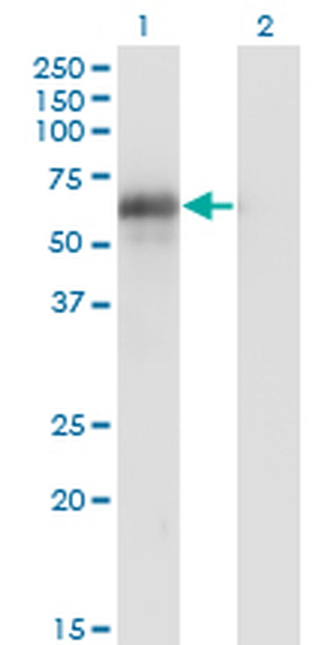 BIN1 Antibody in Western Blot (WB)