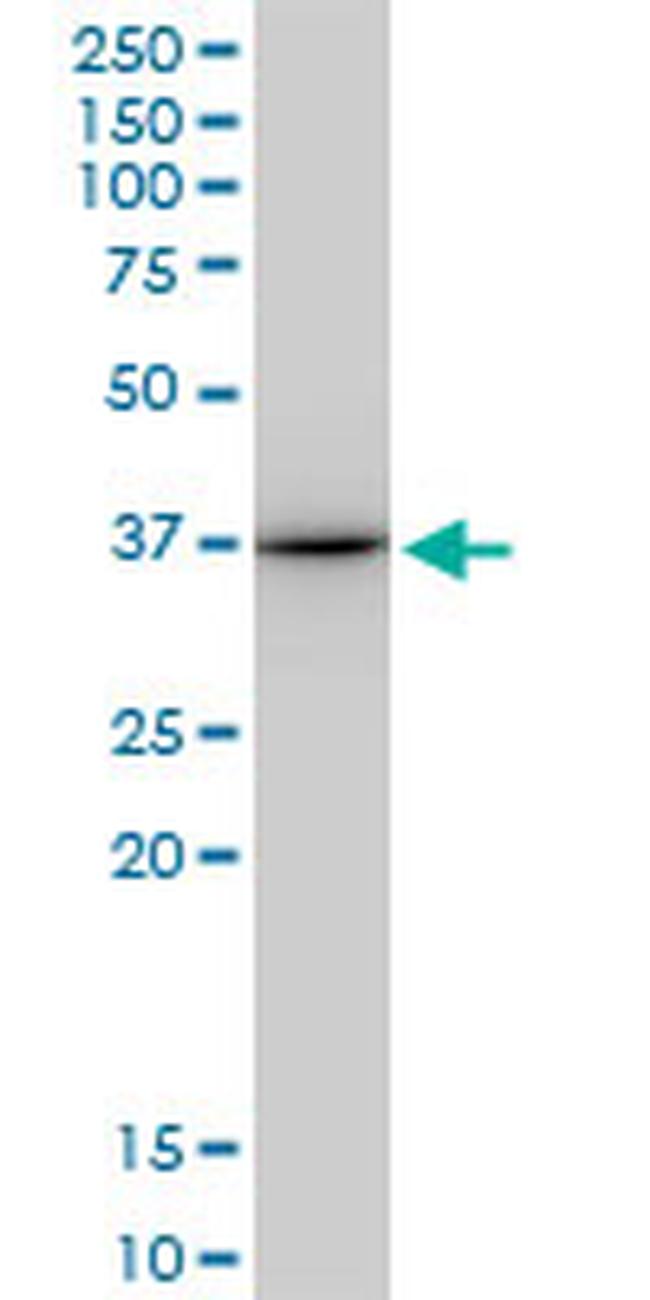 ANXA1 Antibody in Western Blot (WB)
