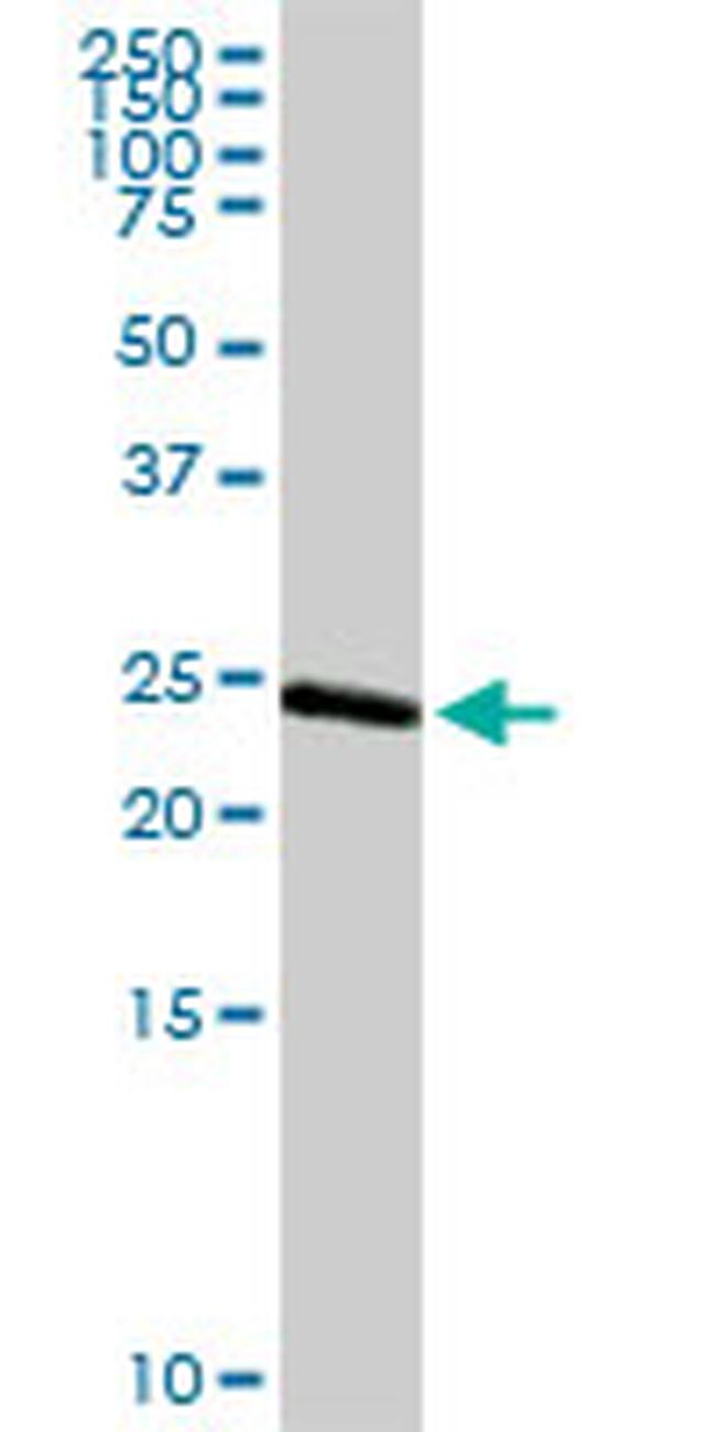 ARHGDIA Antibody in Western Blot (WB)