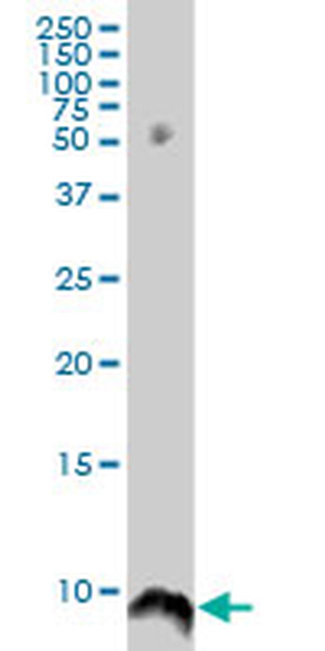 ATOX1 Antibody in Western Blot (WB)