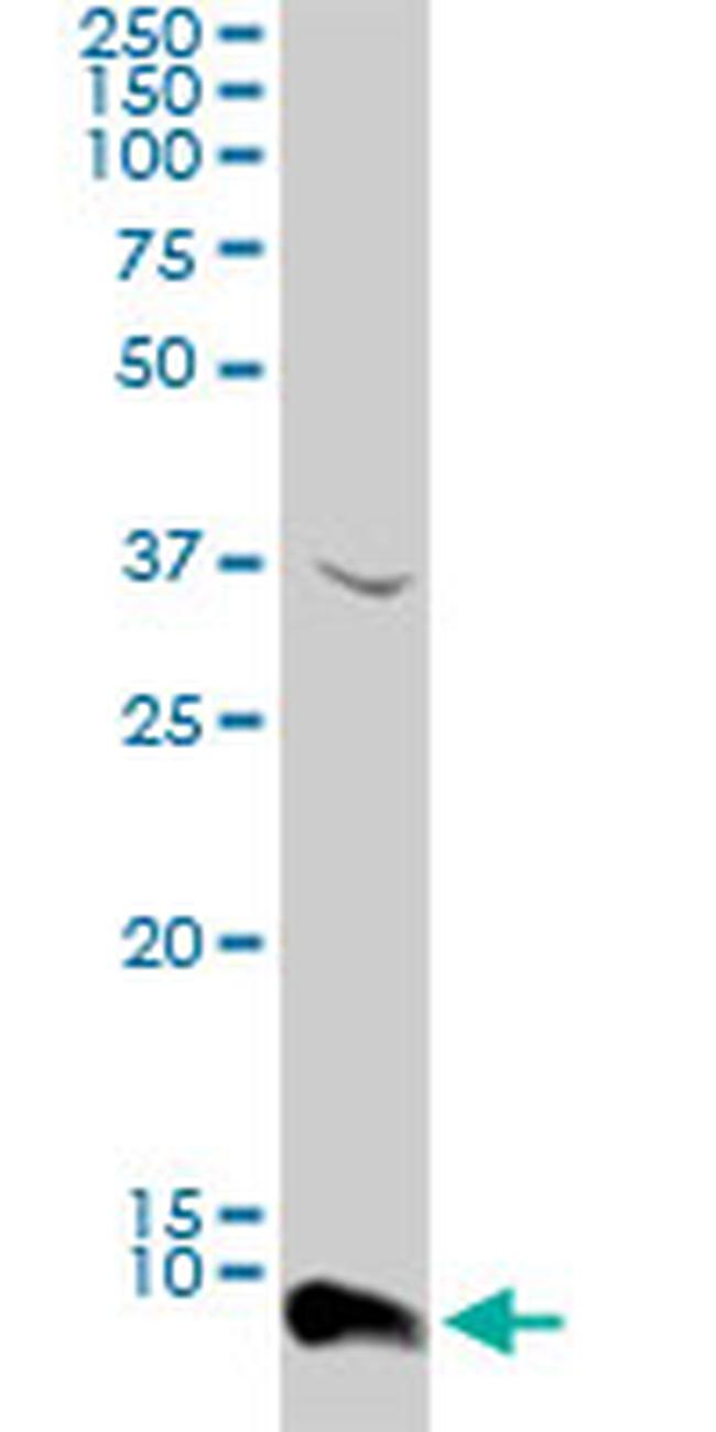 ATOX1 Antibody in Western Blot (WB)