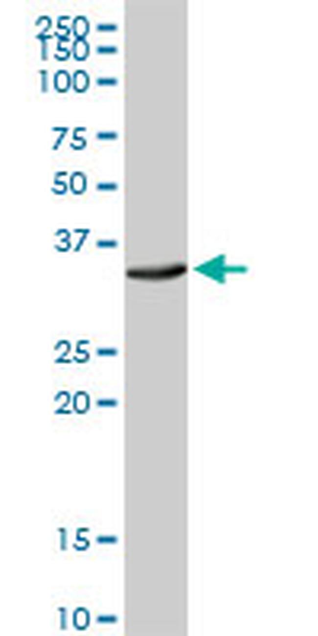 ATP1B3 Antibody in Western Blot (WB)
