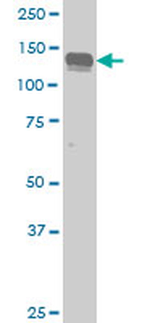 AXL Antibody in Western Blot (WB)