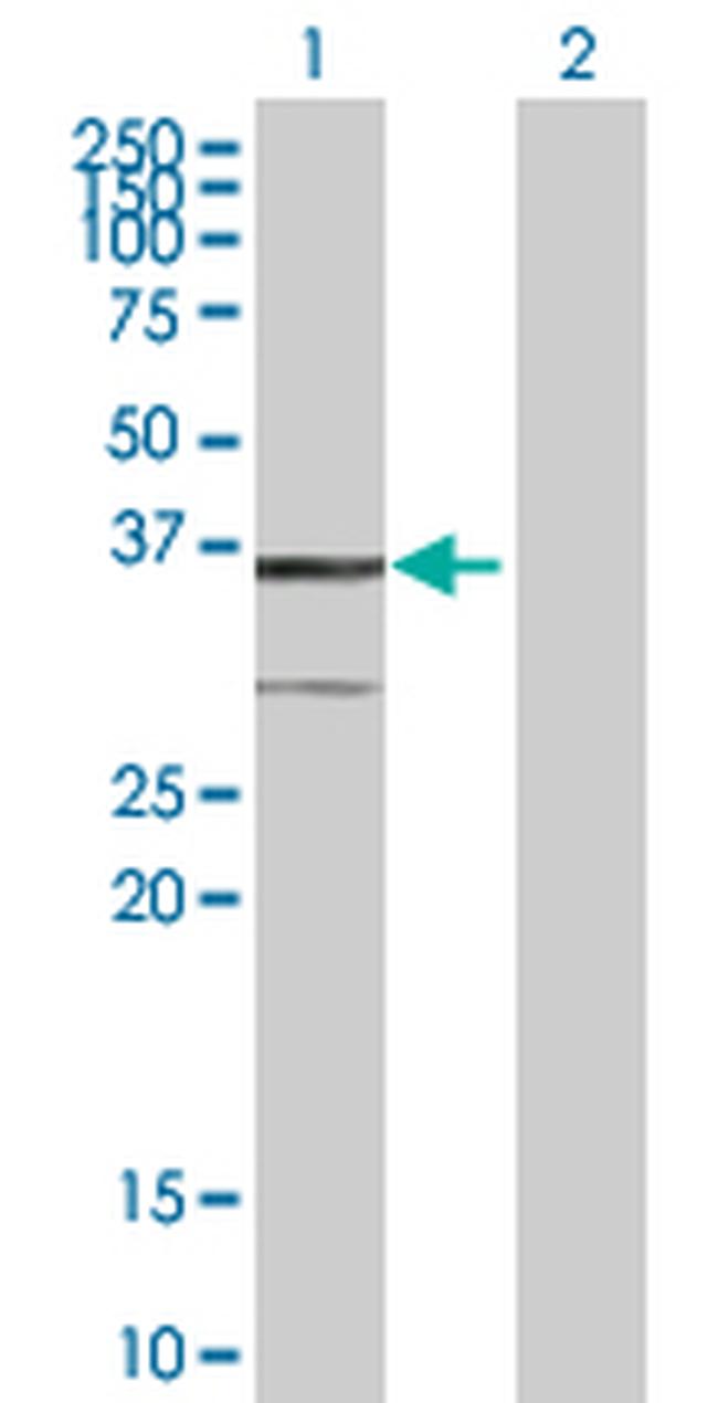 BDH1 Antibody in Western Blot (WB)