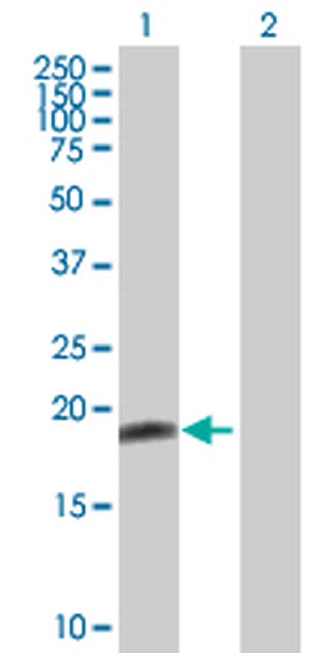 BID Antibody in Western Blot (WB)