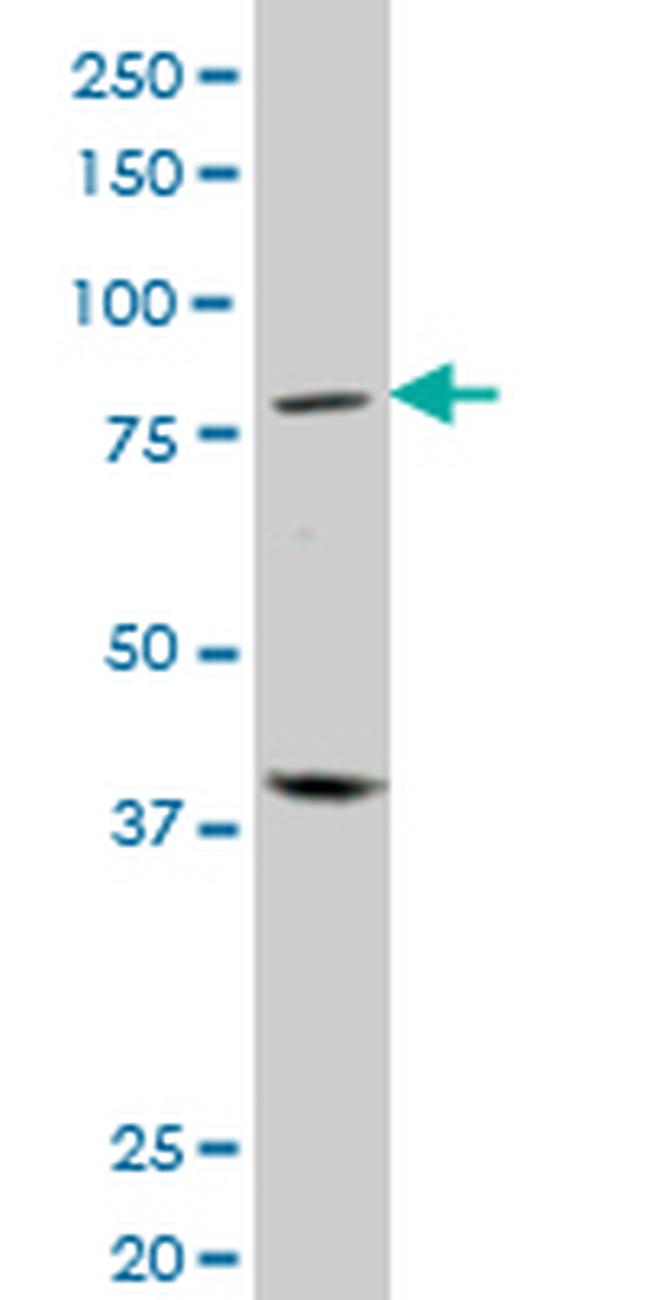 PRDM1 Antibody in Western Blot (WB)