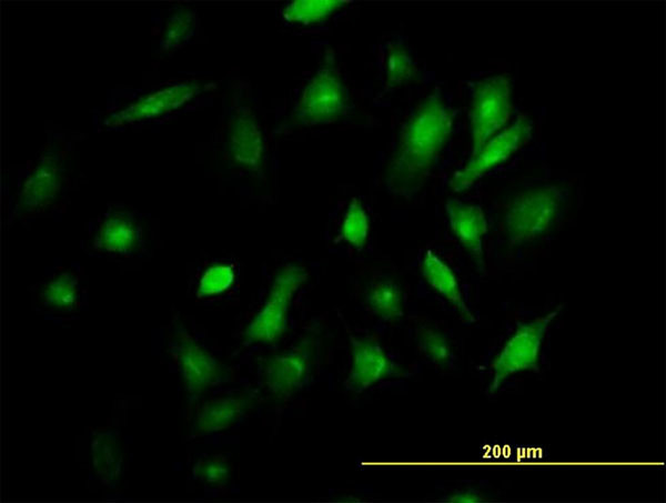 BST2 Antibody in Immunocytochemistry (ICC/IF)