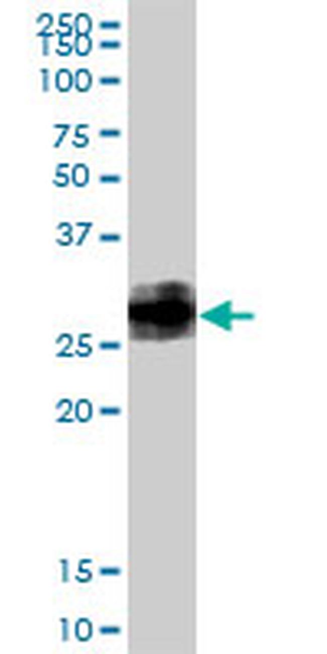 BST2 Antibody in Western Blot (WB)