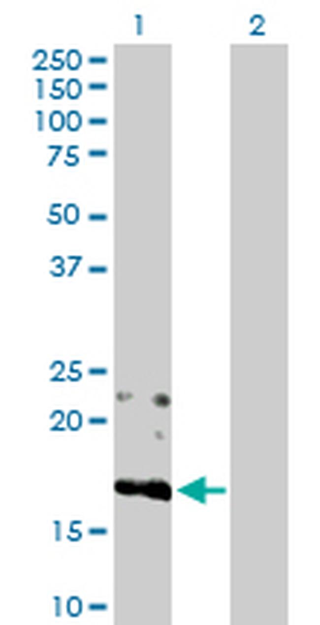 BST2 Antibody in Western Blot (WB)