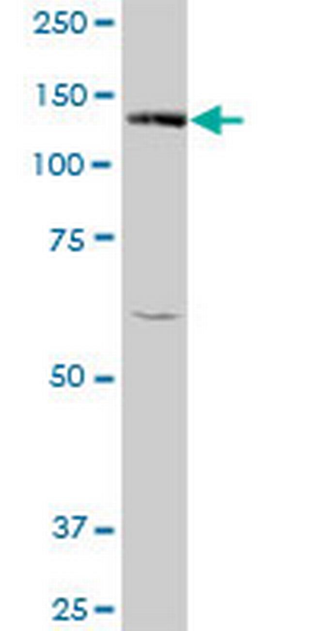 BUB1 Antibody in Western Blot (WB)