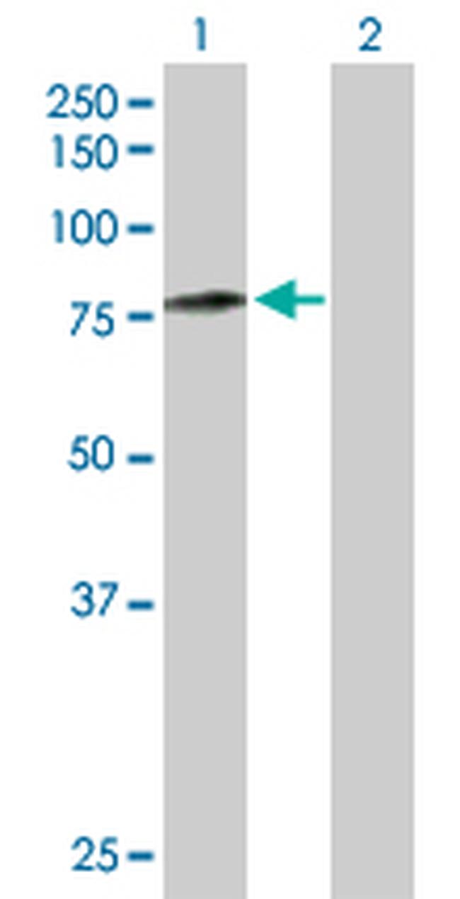 CAPN5 Antibody in Western Blot (WB)