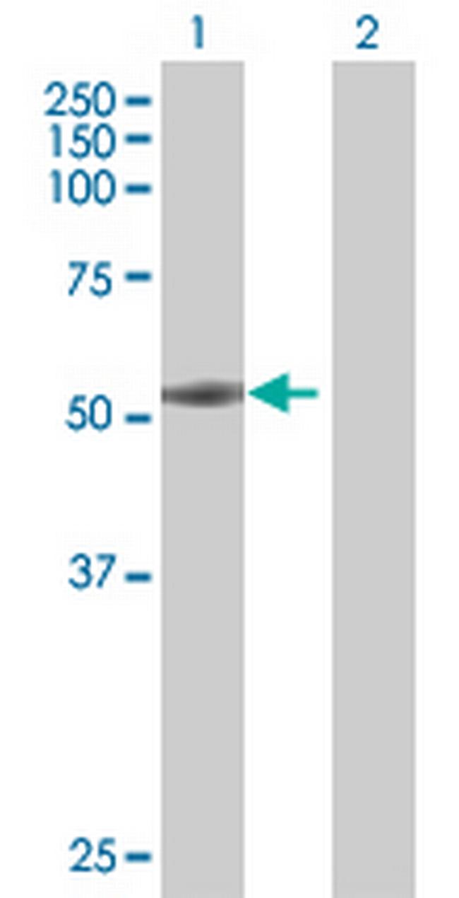 FMNL1 Antibody in Western Blot (WB)