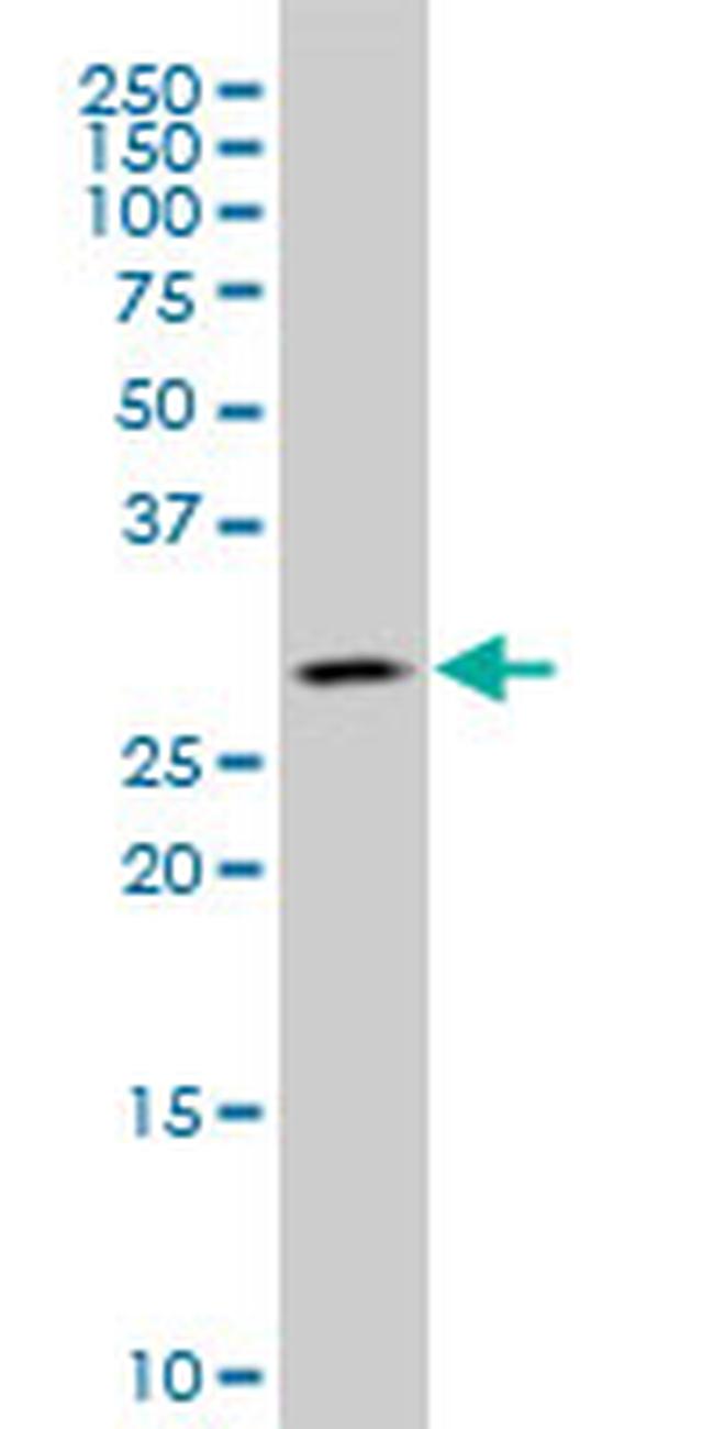 CA1 Antibody in Western Blot (WB)
