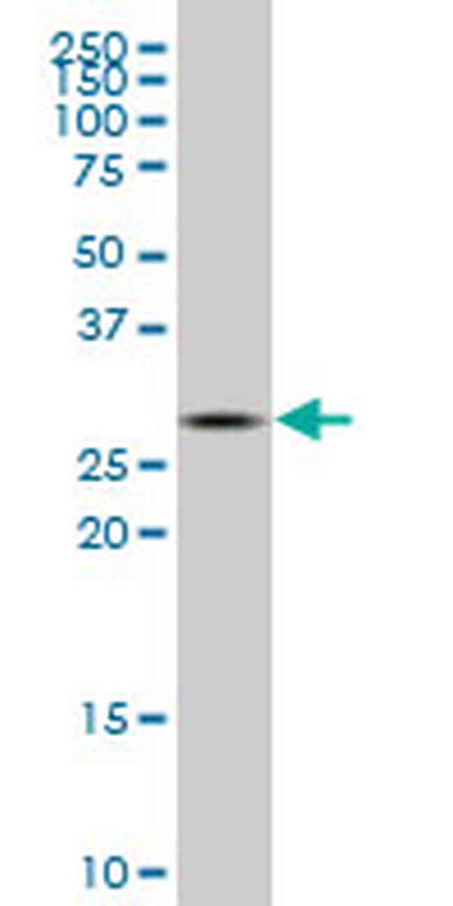 CA1 Antibody in Western Blot (WB)