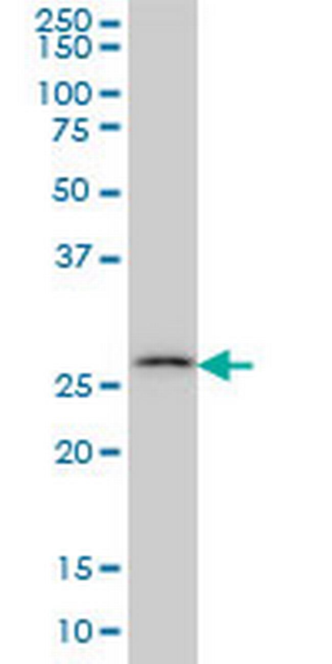 CA7 Antibody in Western Blot (WB)