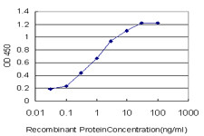 CACNB2 Antibody in ELISA (ELISA)