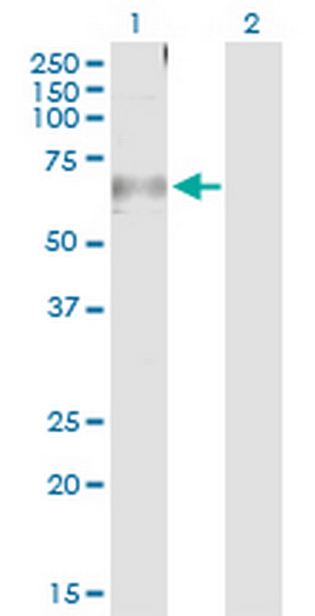 CAMK2A Antibody in Western Blot (WB)