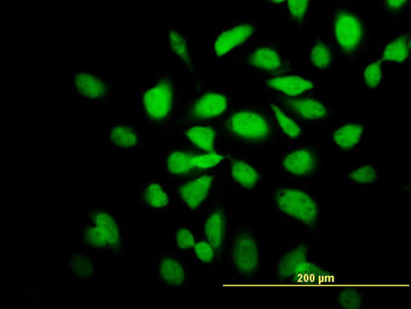 CAMK2A Antibody in Immunocytochemistry (ICC/IF)