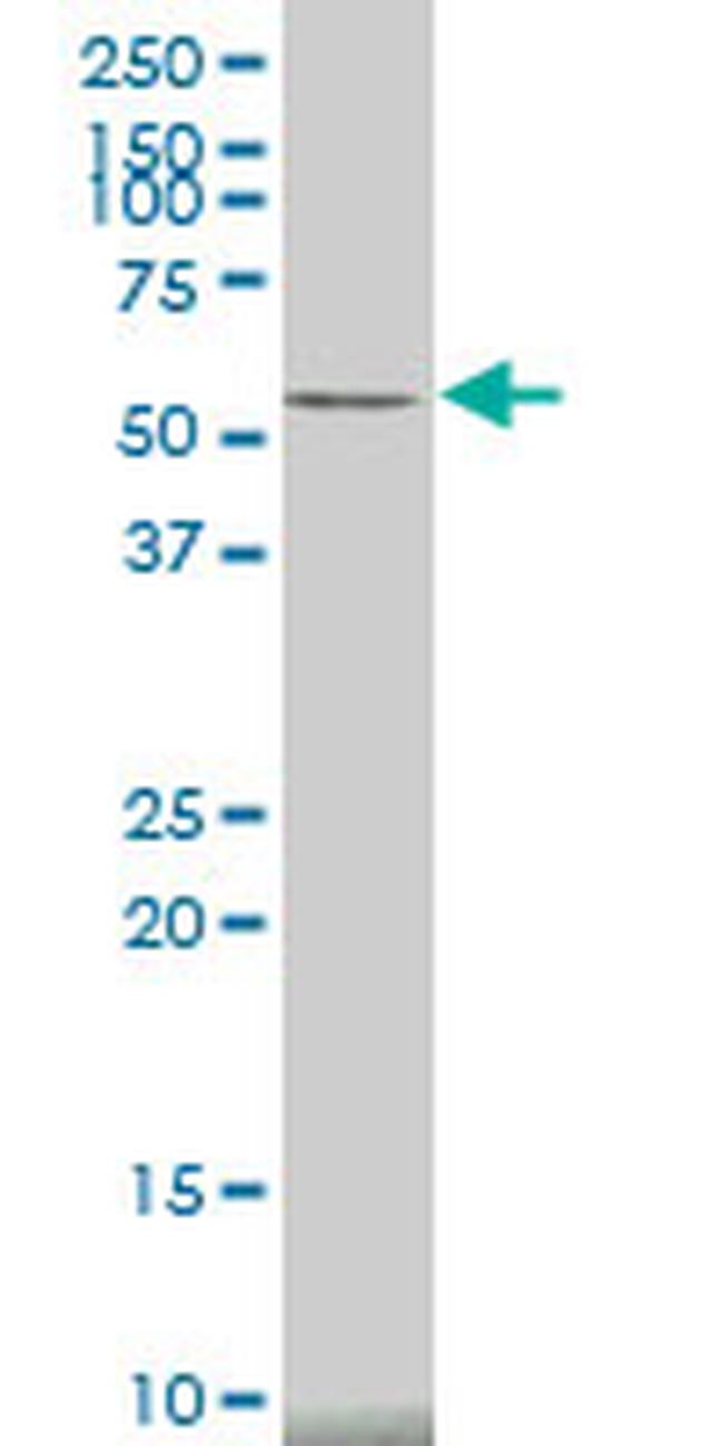 CAMK2A Antibody in Western Blot (WB)