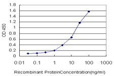 CAMK2B Antibody in ELISA (ELISA)