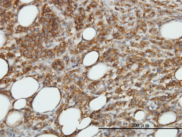 CAMK2B Antibody in Immunohistochemistry (Paraffin) (IHC (P))