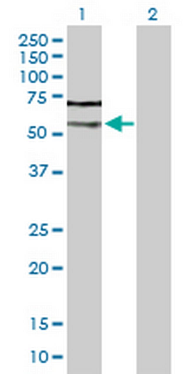 CASP2 Antibody in Western Blot (WB)
