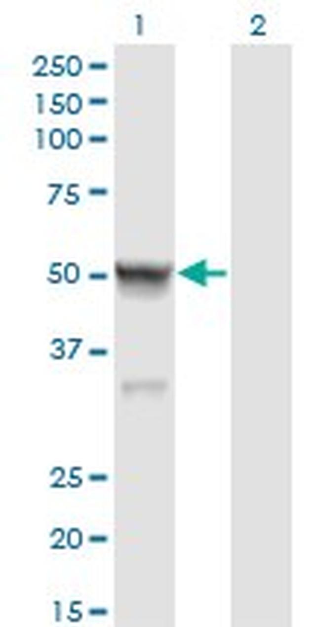 CASQ2 Antibody in Western Blot (WB)