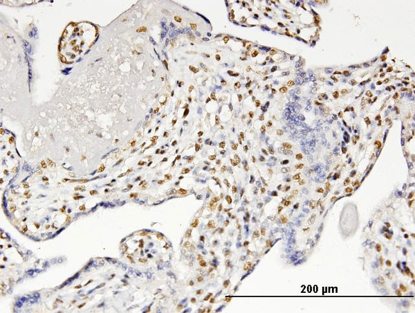 RUNX2 Antibody in Immunohistochemistry (Paraffin) (IHC (P))