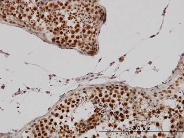 CCNH Antibody in Immunohistochemistry (Paraffin) (IHC (P))