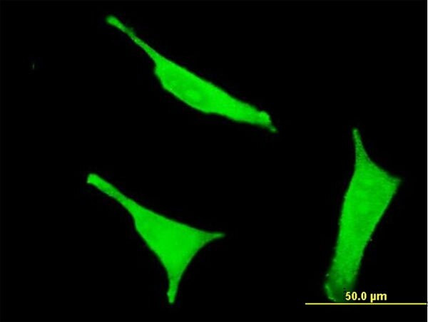 CD38 Antibody in Immunocytochemistry (ICC/IF)