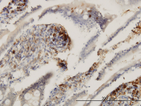 ENTPD6 Antibody in Immunohistochemistry (Paraffin) (IHC (P))