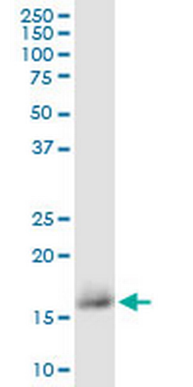 CD59 Antibody in Western Blot (WB)