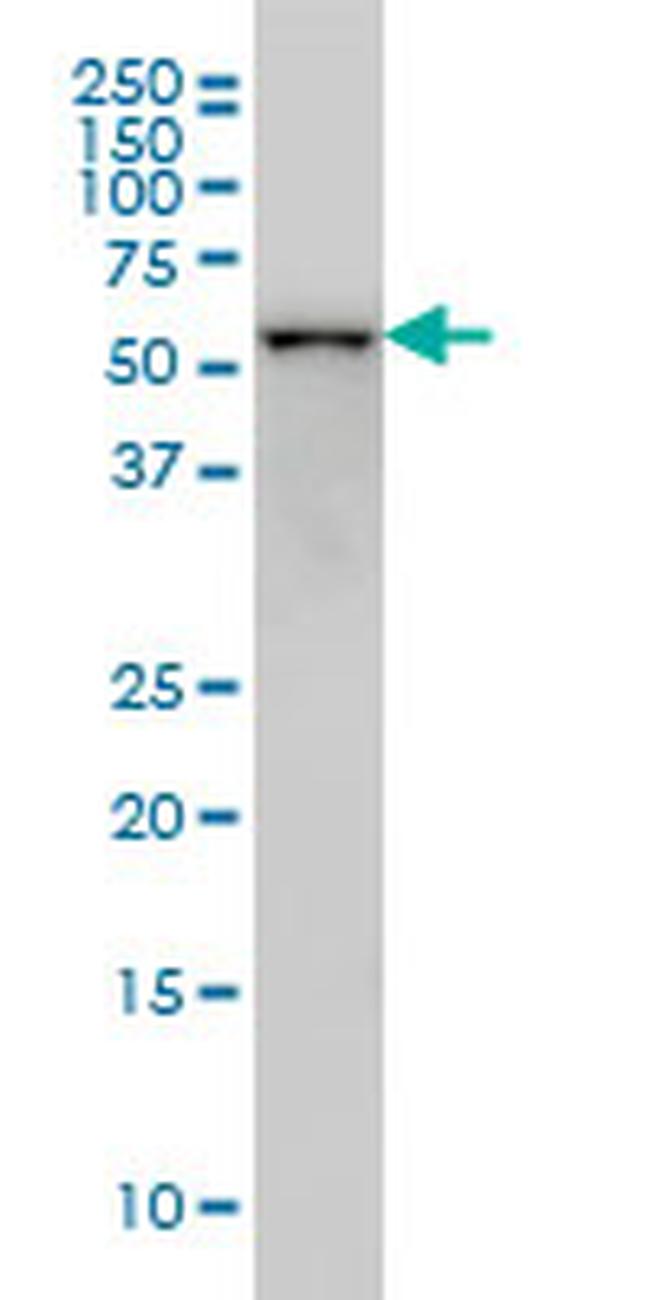 CDK8 Antibody in Western Blot (WB)